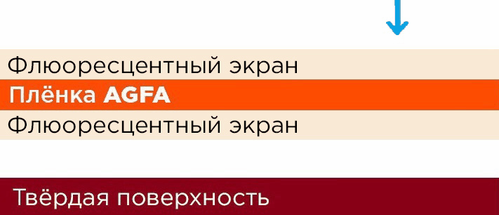 Как выбрать усиливающие экраны фото 6