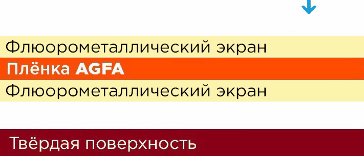Как выбрать усиливающие экраны фото 10