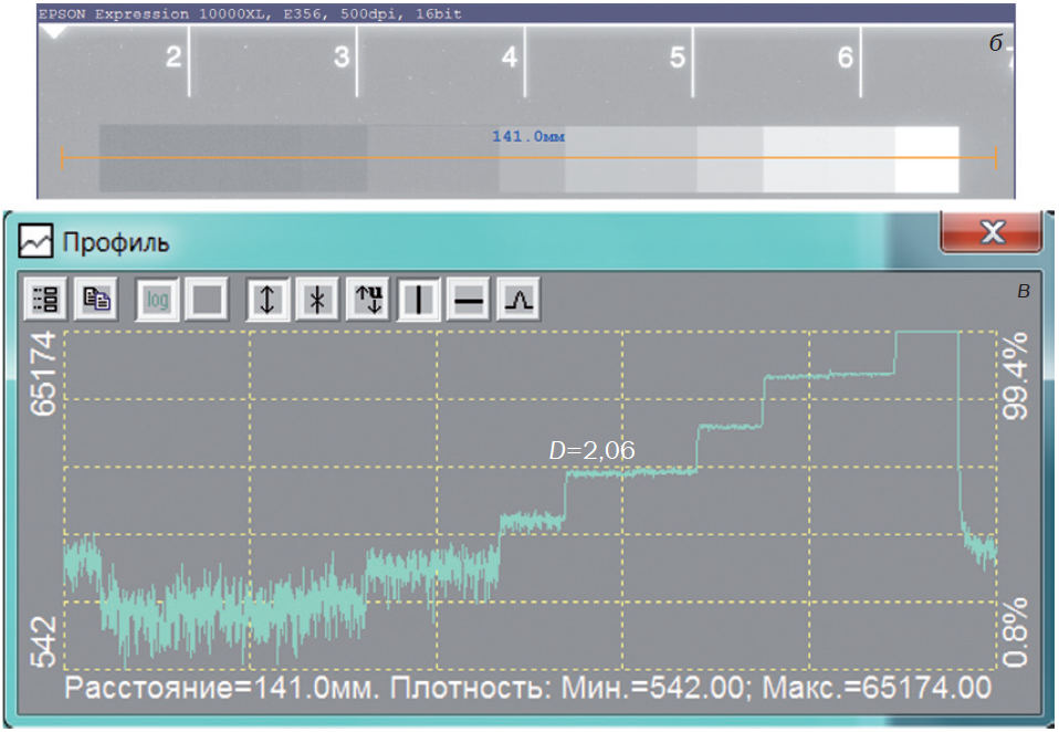 Как выбрать оцифровщик рентгеновских плёнок фото 5